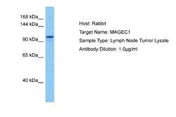 MAGEC1 Rabbit anti-Human, Polyclonal, Novus Biologicals 0.1 mL | Buy Online | Novus Biologicals | Fisher Scientific